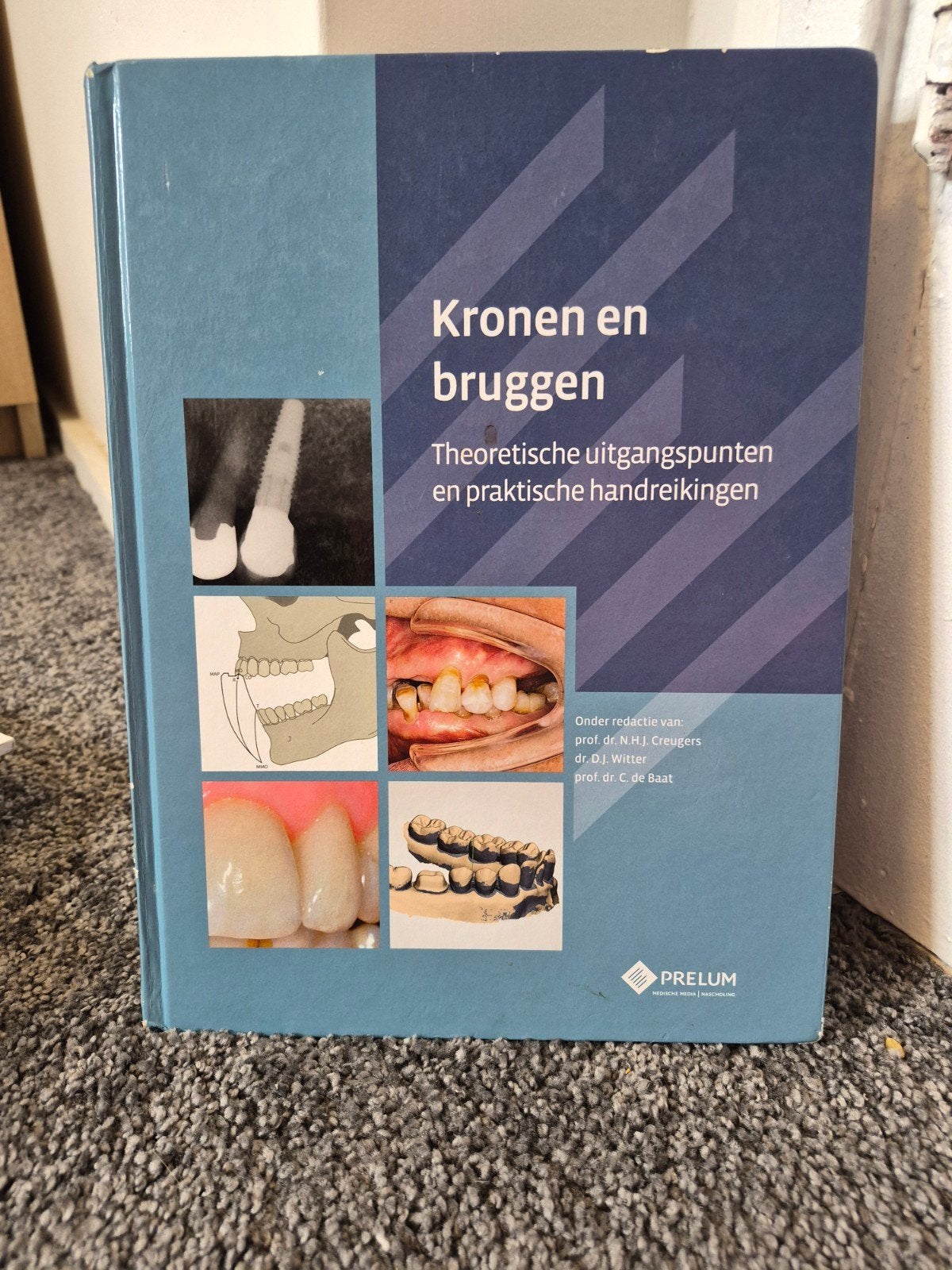 Kronen en bruggen, Boeken, Ophalen of Verzenden, Zo goed als nieuw, Natuurwetenschap