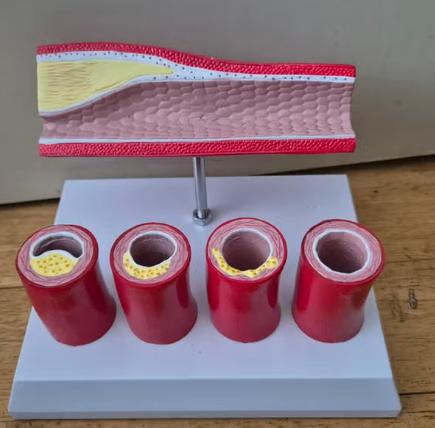 Anatomie model van de binnenkant van een slagader, Ophalen of Verzenden, Nieuw