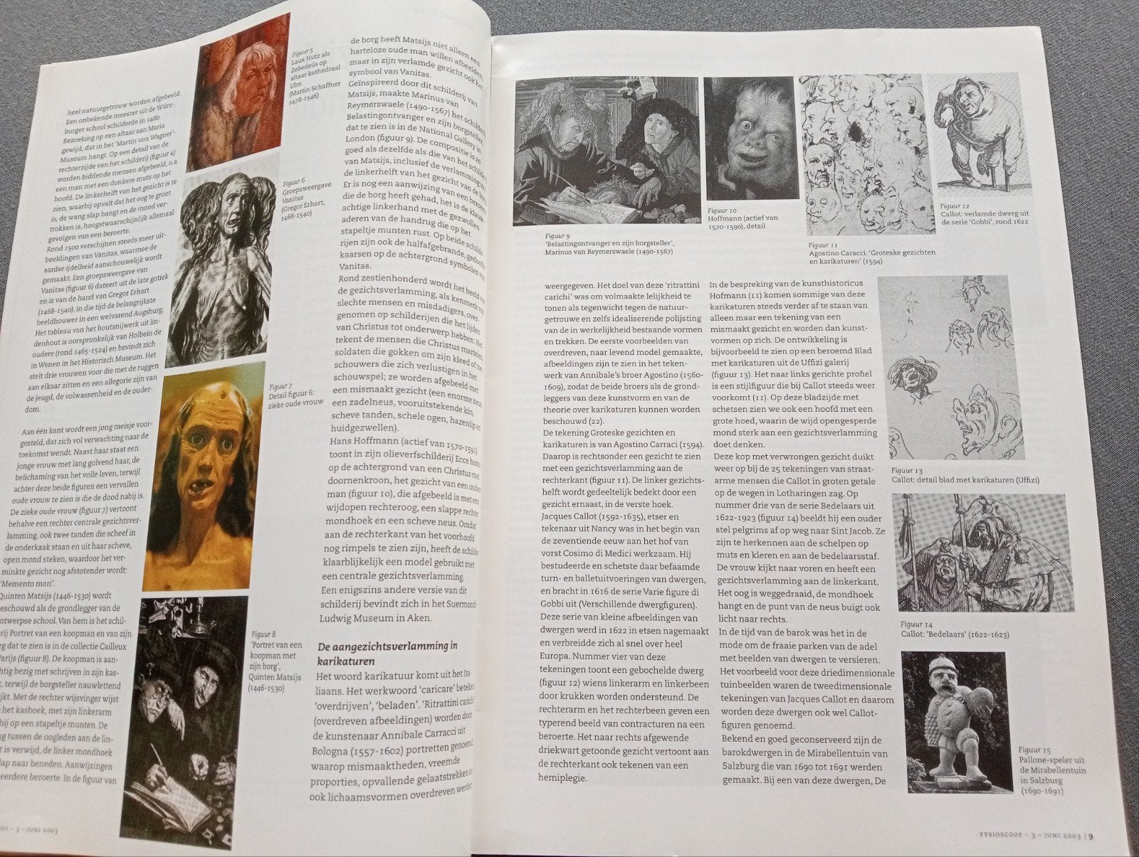 Fysioscoop Tijdschrift - Juni 2003: Sportblessures, Kunst, Ophalen of Verzenden, Gelezen, Wetenschap en Natuur