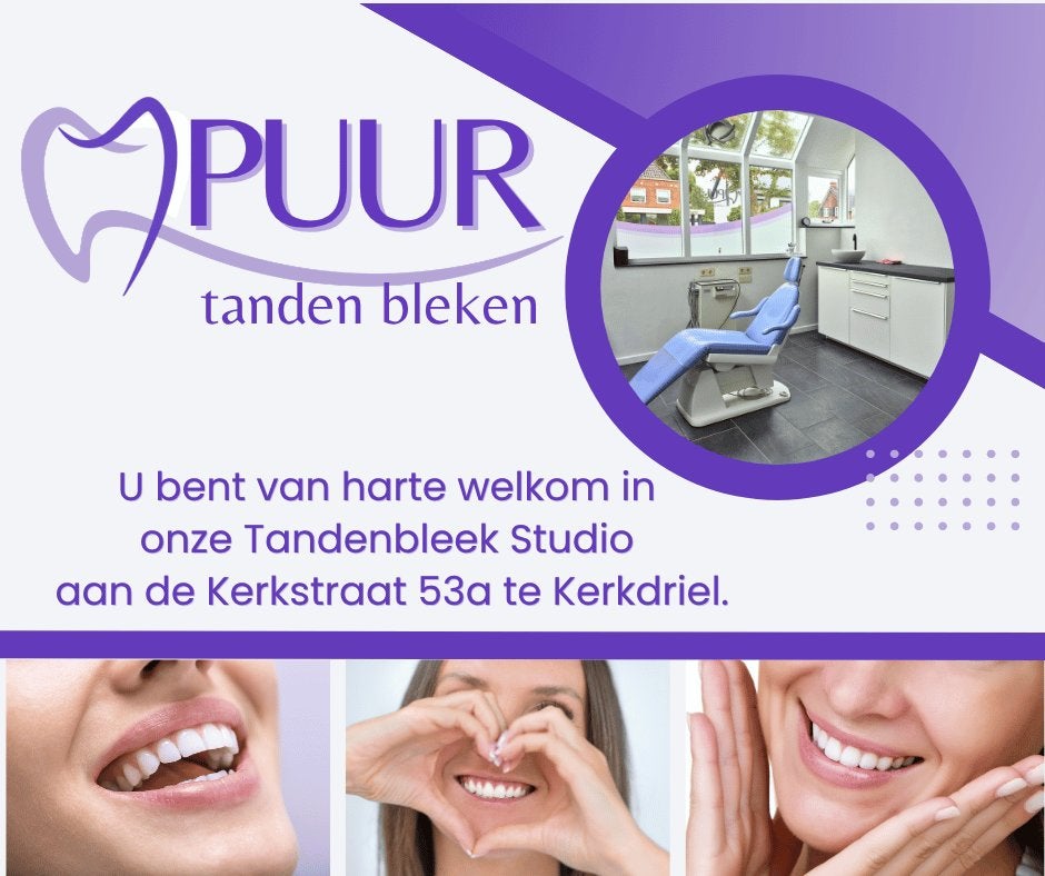 Tanden Bleken, Overige