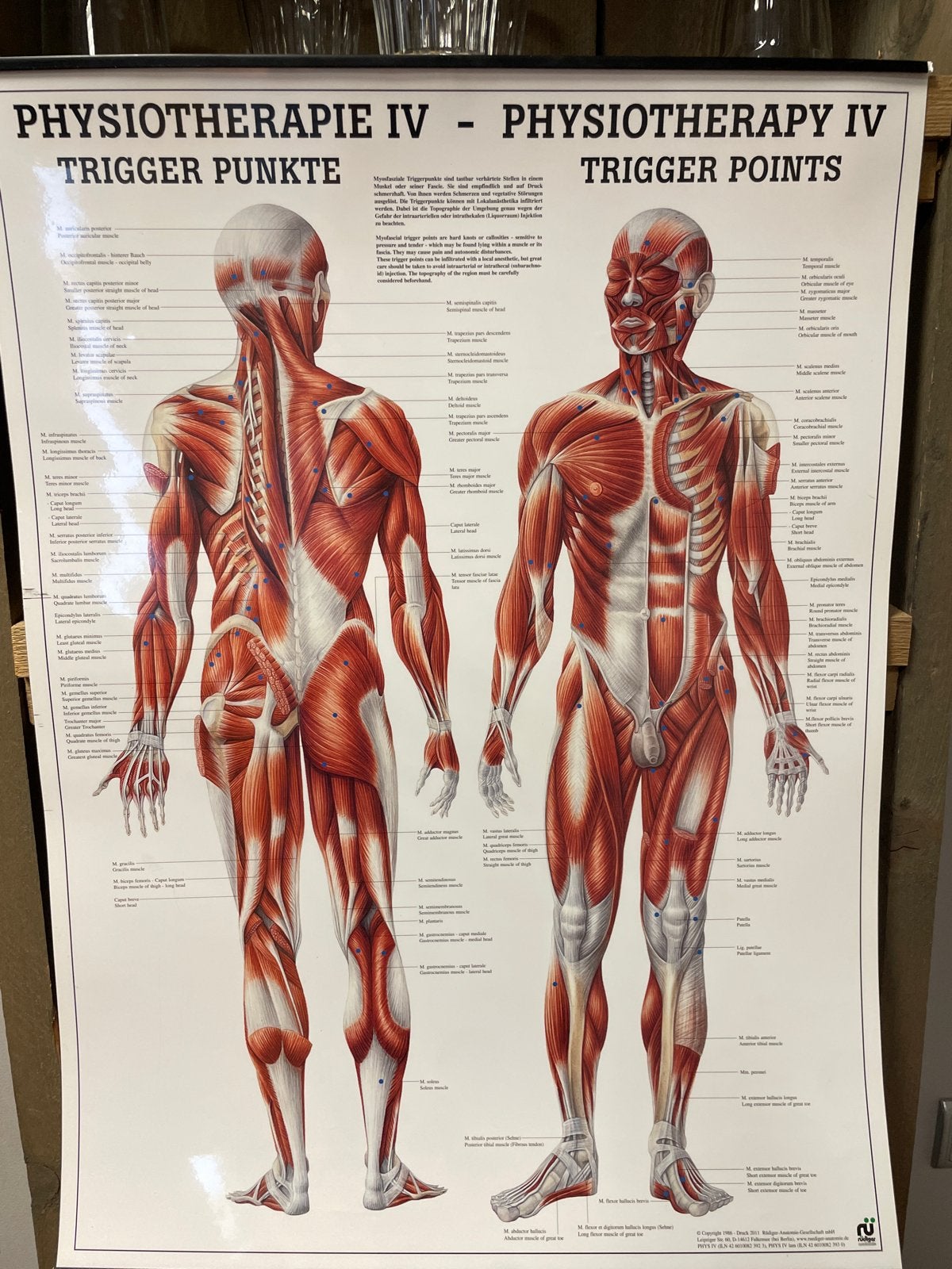 Fysiotherapie Poster - Triggerpunten Anatomie (Nieuw), Nieuw, Ophalen of Verzenden, Foto of Poster, 75 – 100