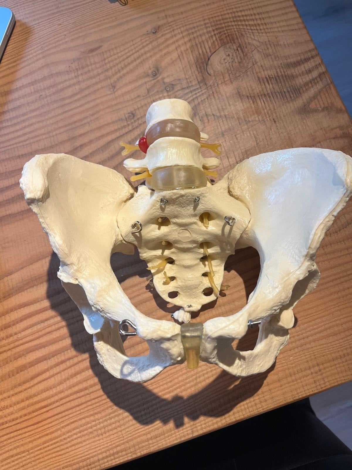 Bekken, Ophalen of Verzenden