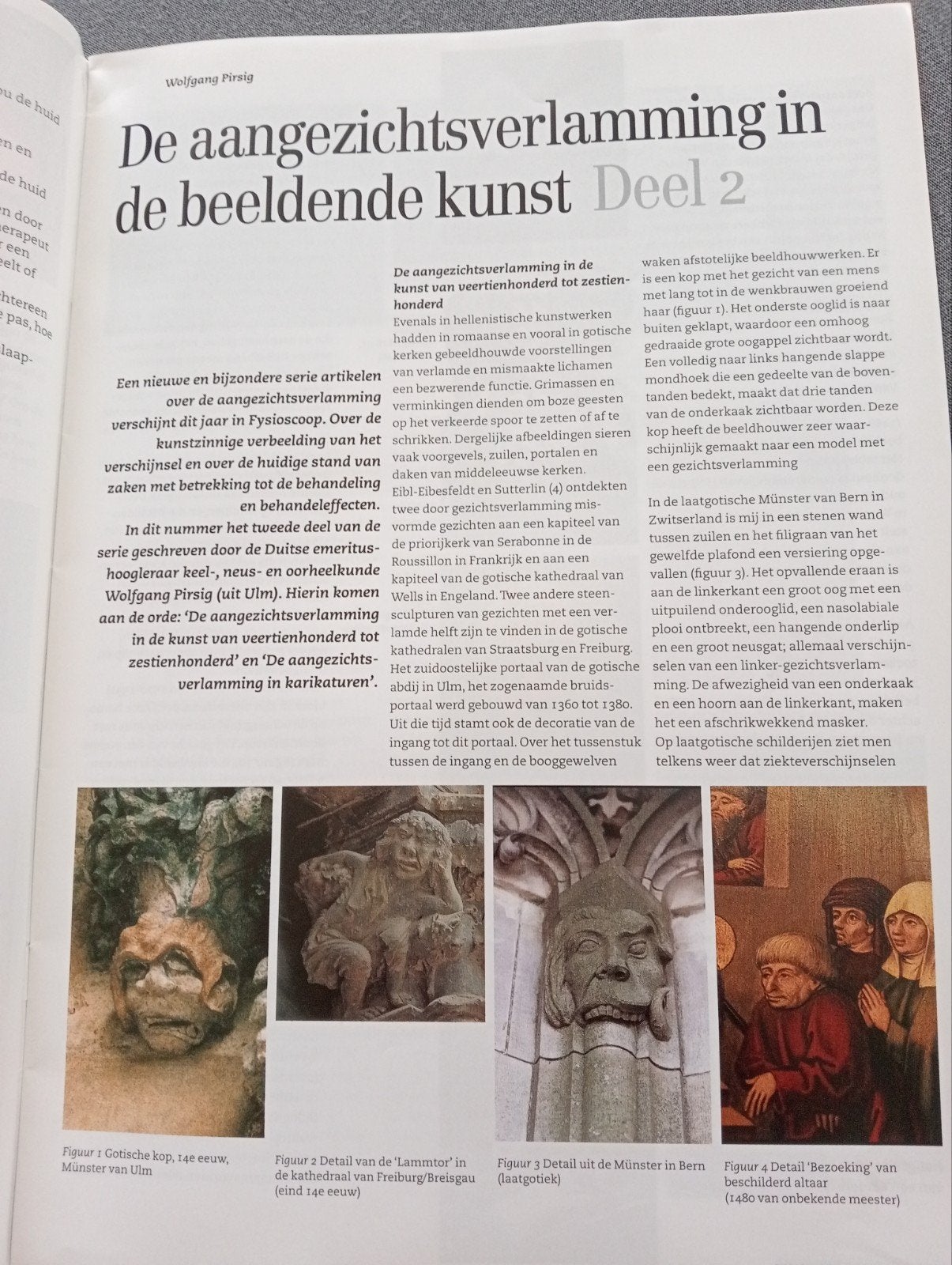 Fysioscoop Tijdschrift - Juni 2003: Sportblessures, Kunst, Ophalen of Verzenden, Gelezen, Wetenschap en Natuur