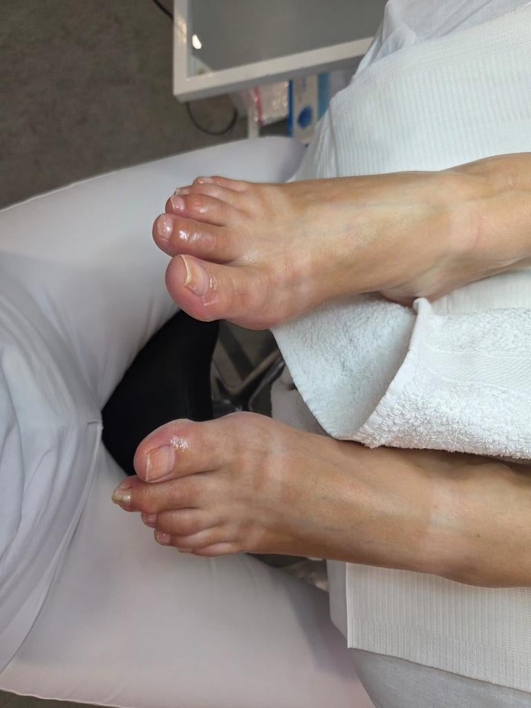 Pedicure modellen gezocht