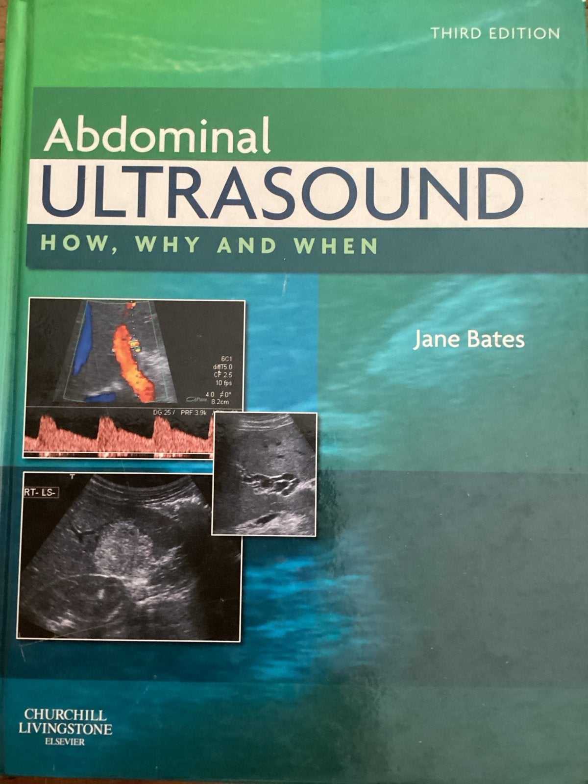 Abdominal Ultrasound: How, Why and When, Boeken, Ophalen of Verzenden, Beta, Zo goed als nieuw, HBO