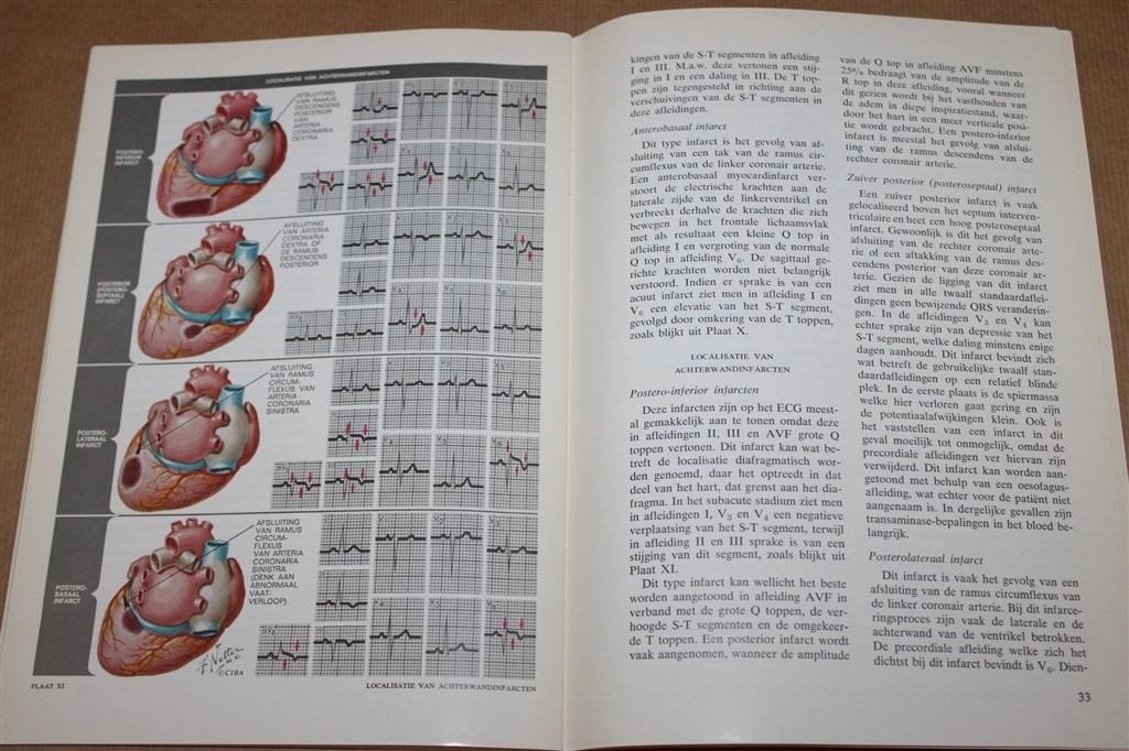 Electrocardiografie voor de medicus practicus., Boeken, Ophalen of Verzenden, Gelezen
