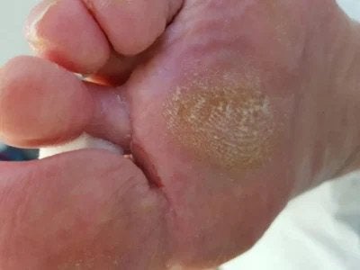 Model gezocht voor pedicure examen, Overige uren, Overige niveaus, Overige vormen