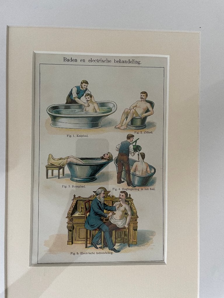 Ingelijste historische medische illustratie, Ophalen, Zeefdruk, Print/reproductie