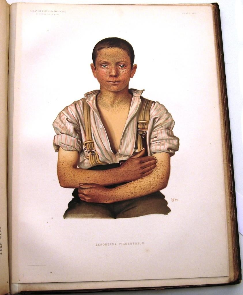 Atlas of Clinical Medicine Vol. 1&2 1892-3 Bramwell Medisch, Ophalen of Verzenden