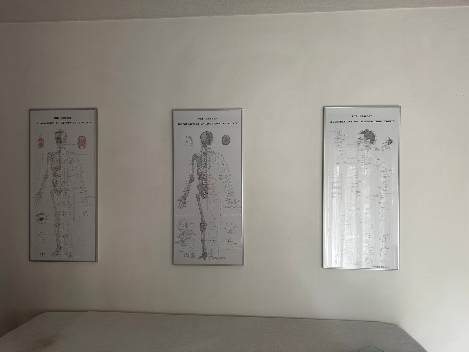 Meridianen en acupunctuur punten posters, Ophalen of Verzenden