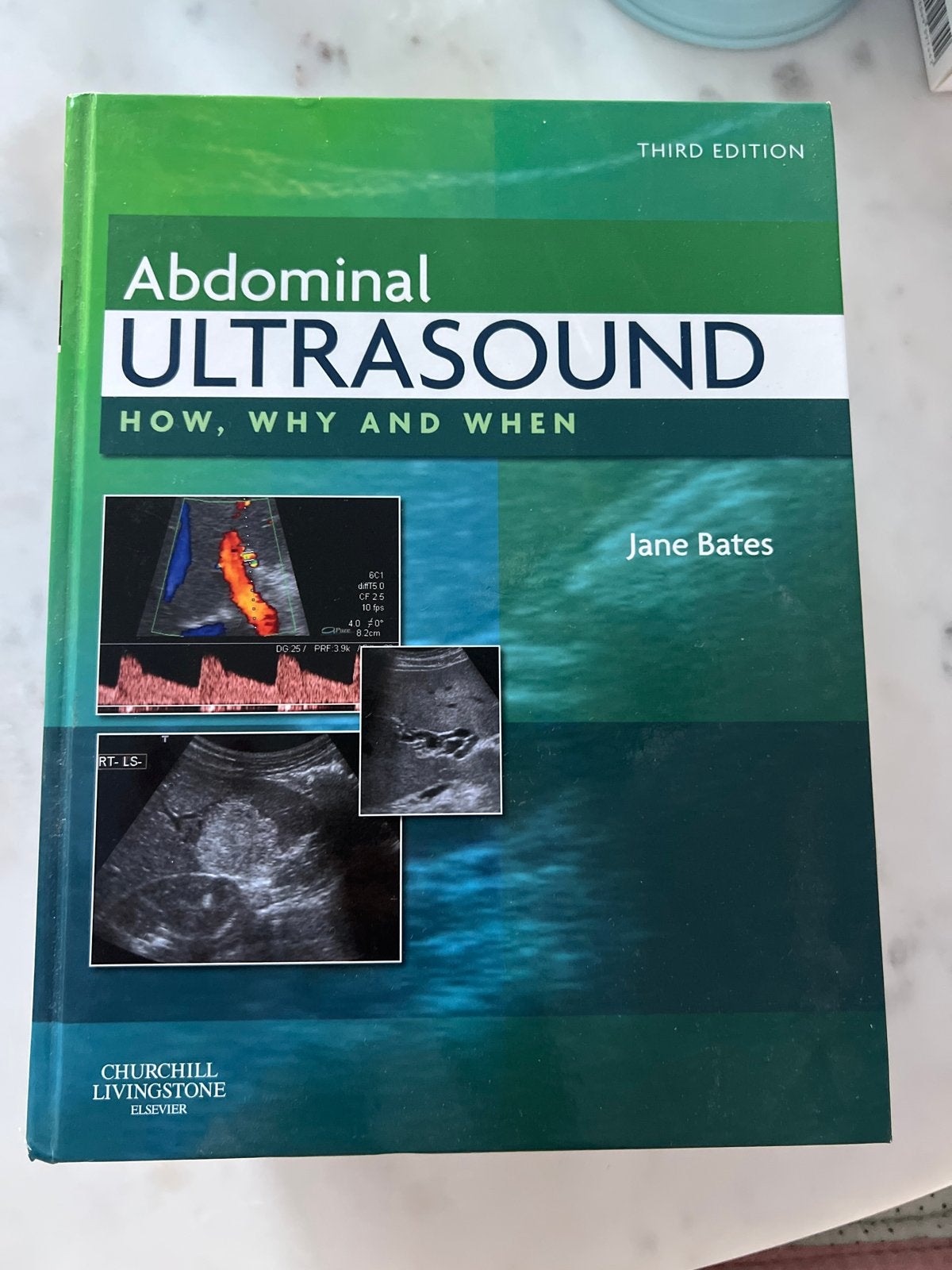 Abdominal Ultrasound: How, Why and When - Jane Bates, Boeken, Ophalen, Gelezen