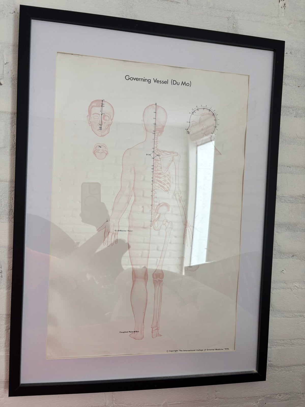 Posters accupunctuur | wellness | massage, Ophalen, Zo goed als nieuw