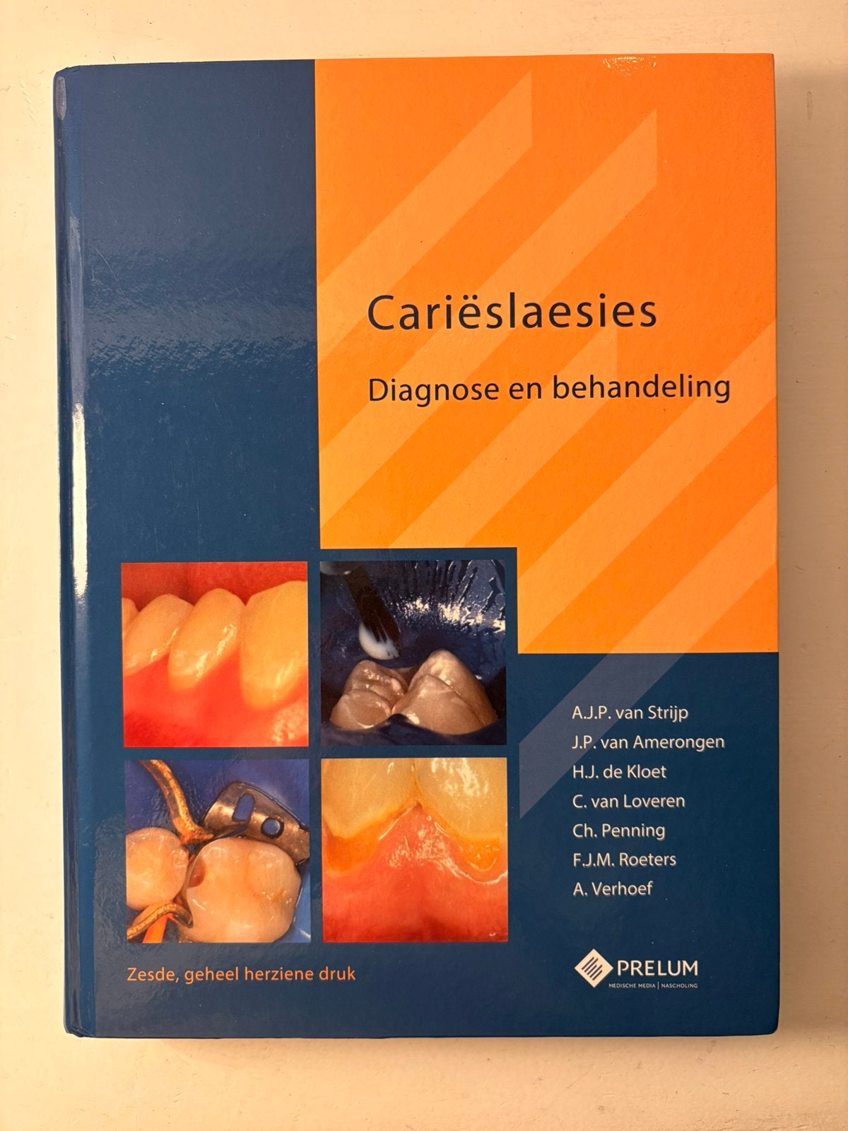 Cariëslaesies Diagnose en behandeling, Boeken, Ophalen of Verzenden, Beta, Zo goed als nieuw, HBO