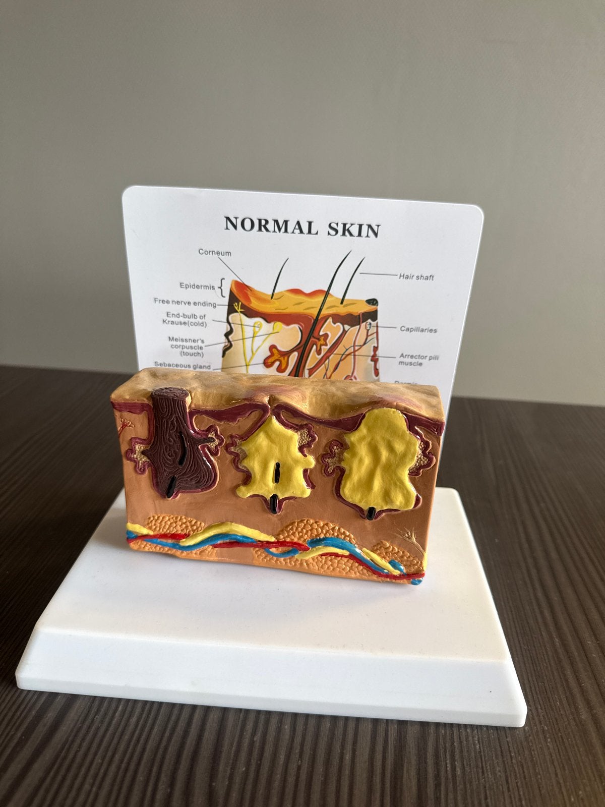 Huidmodel: anatomie Normale huid en huidaandoeningen (acne), Boeken, Studieboeken en Cursussen, Ophalen of Verzenden, Beta, Zo goed als nieuw