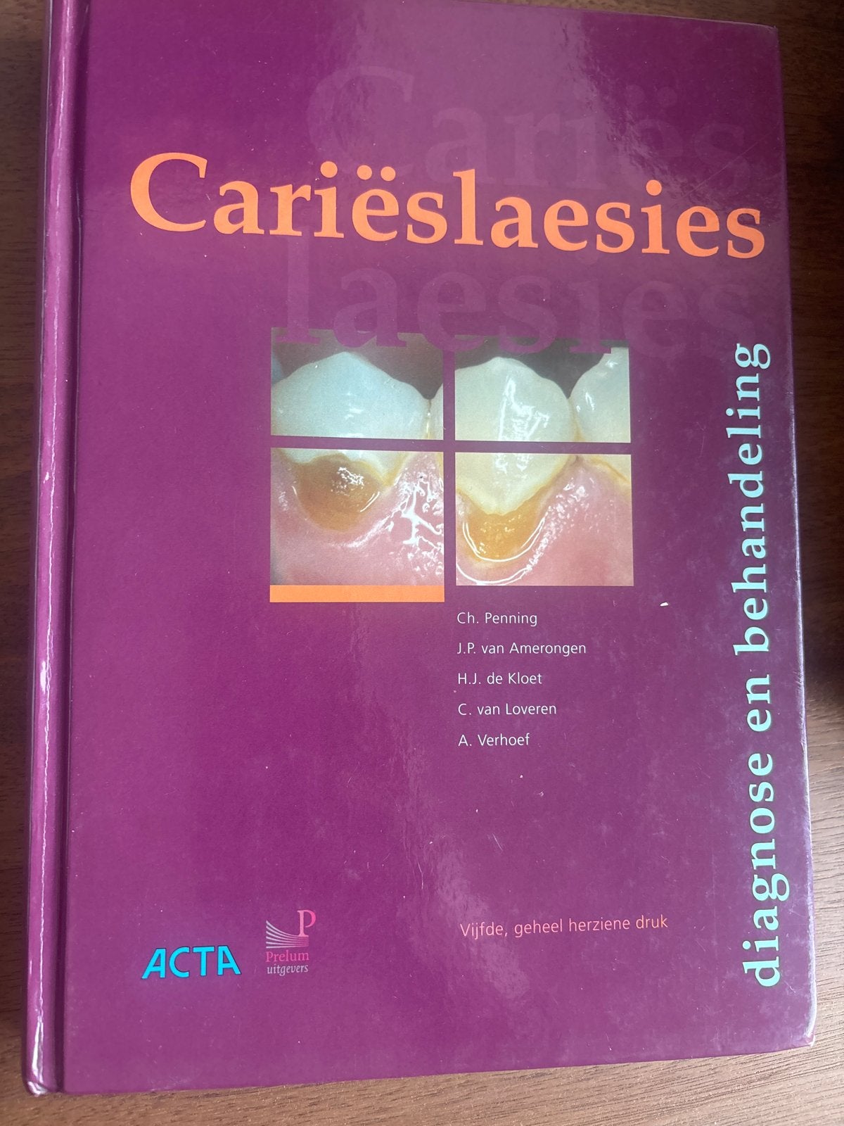 Cariëslaesies: diagnose en behandeling - 5e druk, Ophalen of Verzenden, Beta, Zo goed als nieuw, WO