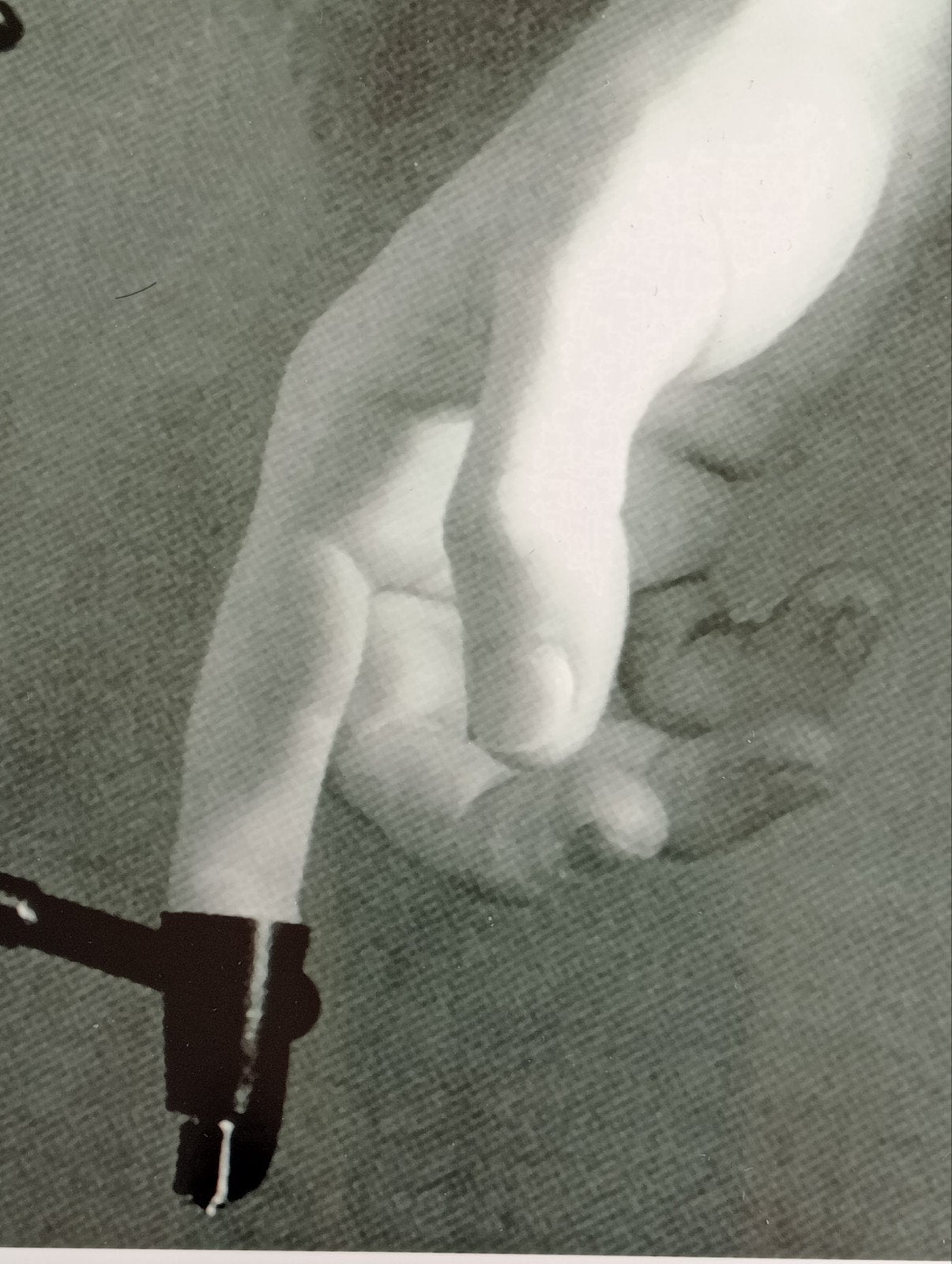Medische foto vinger bloedprikken jaren 80-90, Ophalen of Verzenden, 1980 tot heden, Zo goed als nieuw, Overige onderwerpen