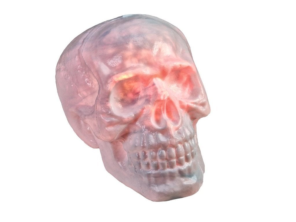 Europalms Halloween Skull animated 31cm, Halloween of Griezel, ., Nieuw, Ophalen of Verzenden