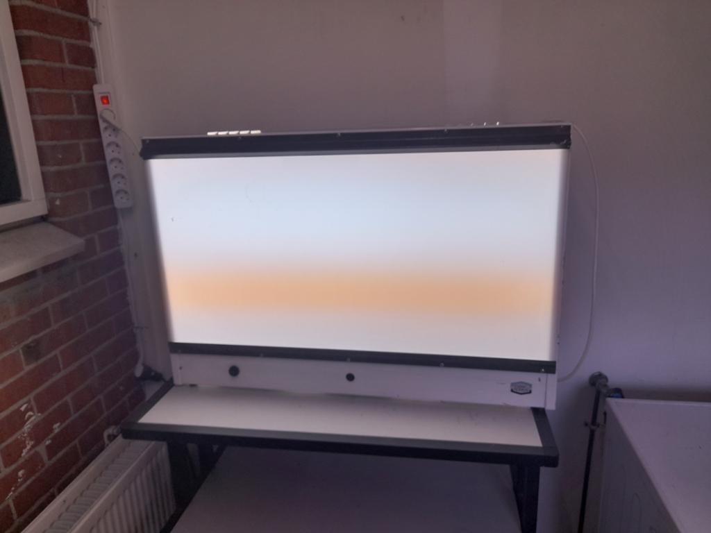 Vintage Enraf Nonius röntgen lichtbak, Ophalen, Gebruikt, Vintage
