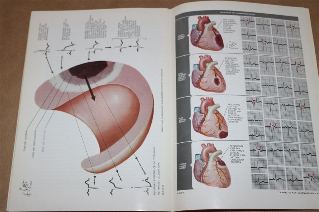 Electrocardiografie voor de medicus practicus., Boeken, Ophalen of Verzenden, Gelezen