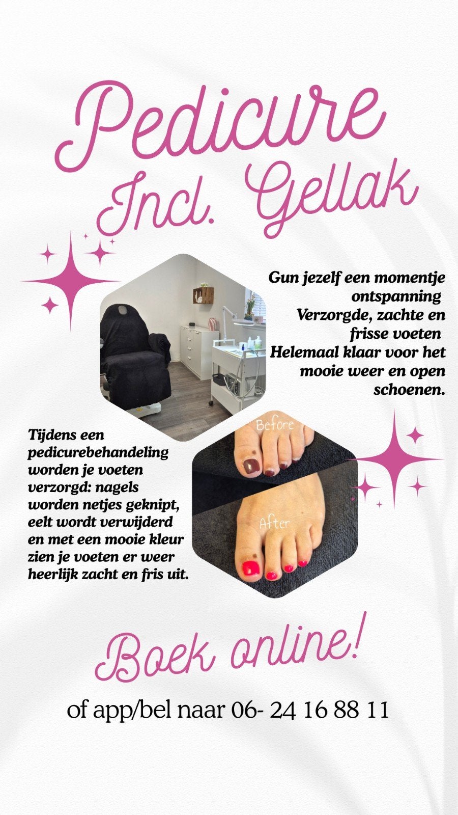pedicure behandeling incl lakken met gellak in Heerhugowaard, Ophalen, Nieuw, Overige typen