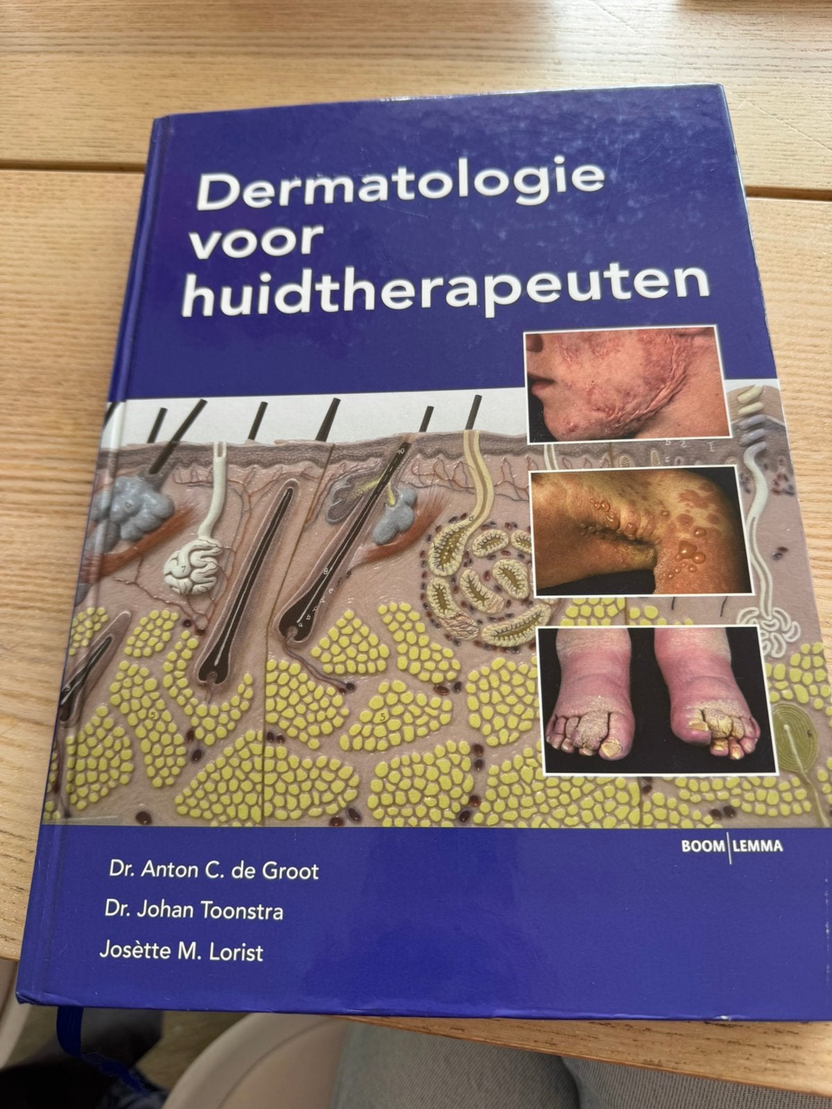A.C. de Groot - Dermatologie voor huidtherapeuten, Sociale wetenschap, Ophalen of Verzenden, Zo goed als nieuw, A.C. de Groot; Johan Toonstra; J.M. Lorist