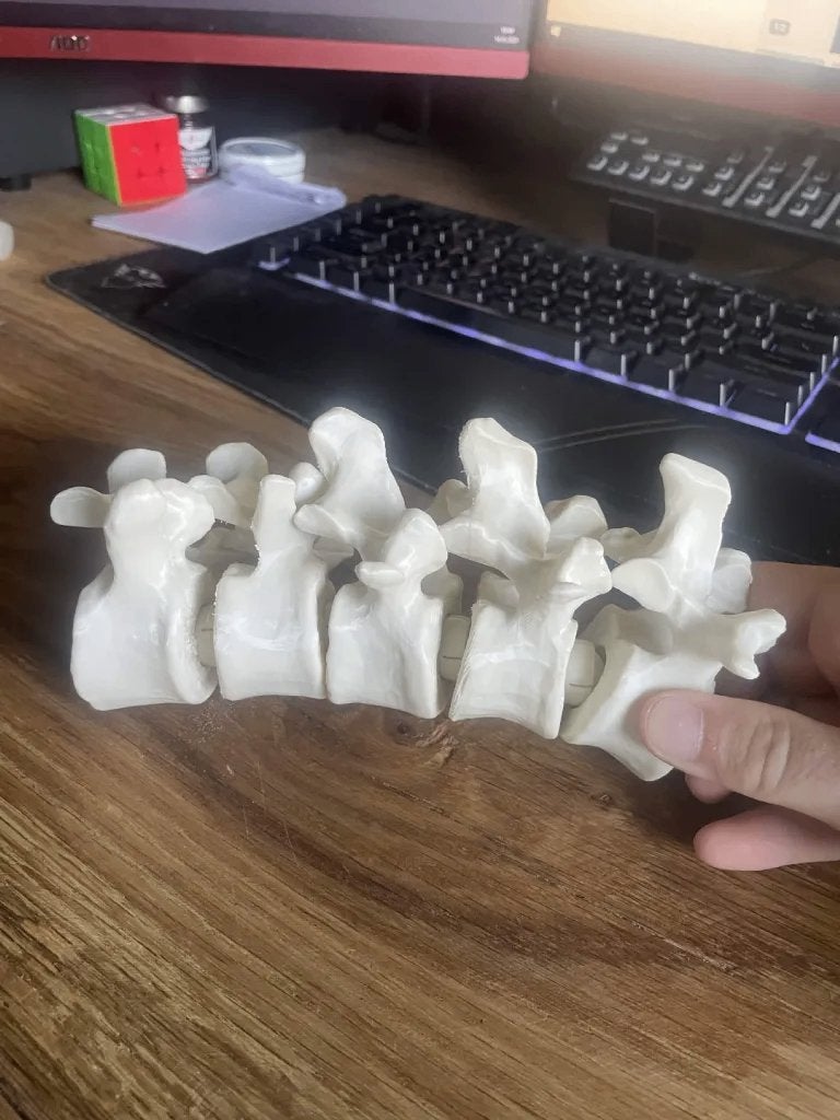 ruggengraat ct scan accuraat 3d print, Verzenden