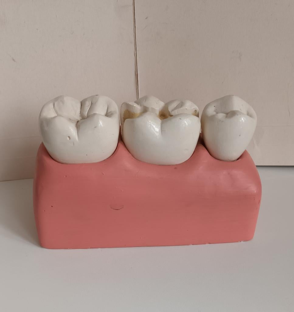Antiek groot Medisch Anatomisch model van Kaak met Kiezen, Ophalen of Verzenden