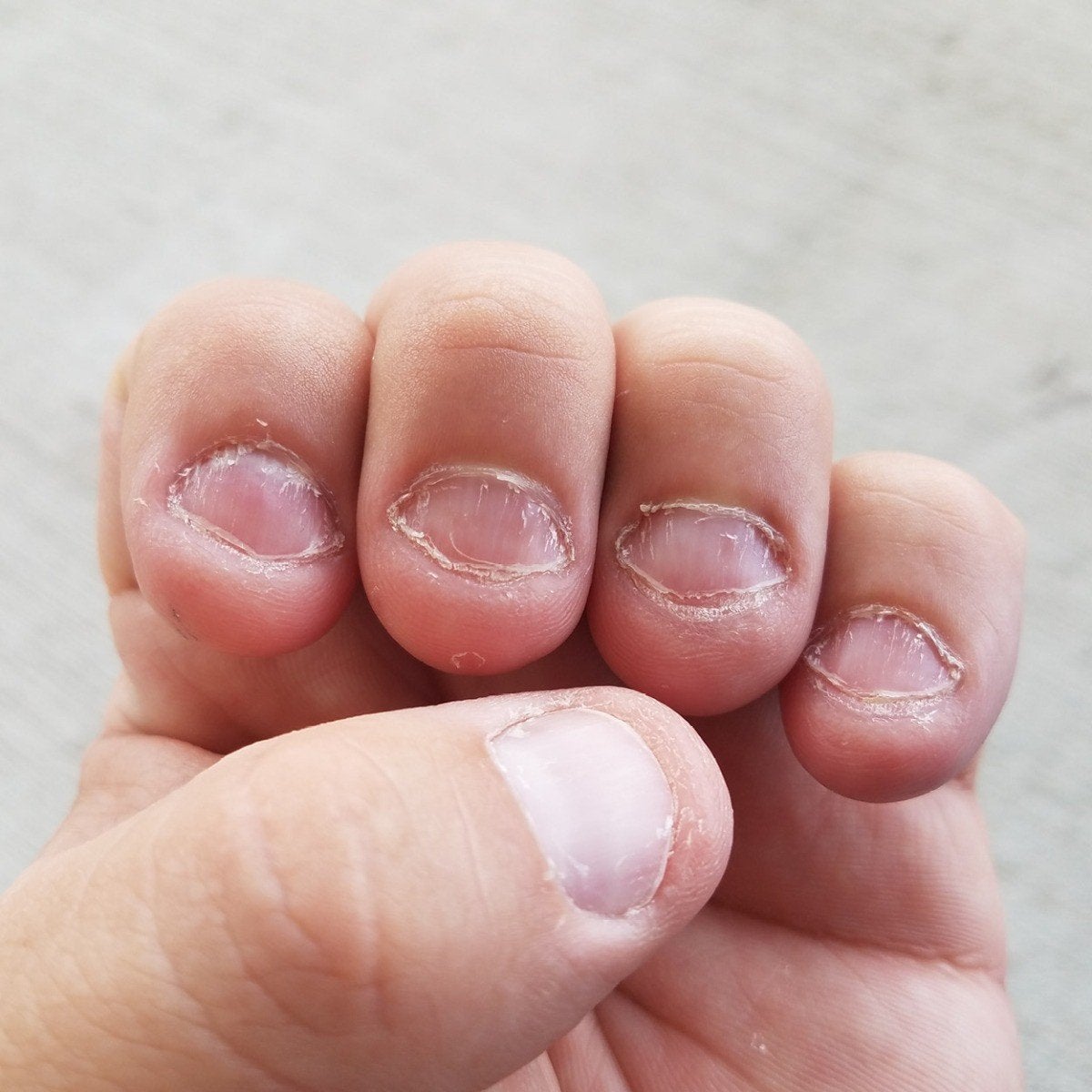 Model nagelbijten gezocht, Ophalen of Verzenden