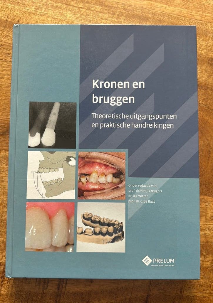 Kronen en bruggen 9789085621348, Boeken, Ophalen of Verzenden, Zo goed als nieuw, MBO