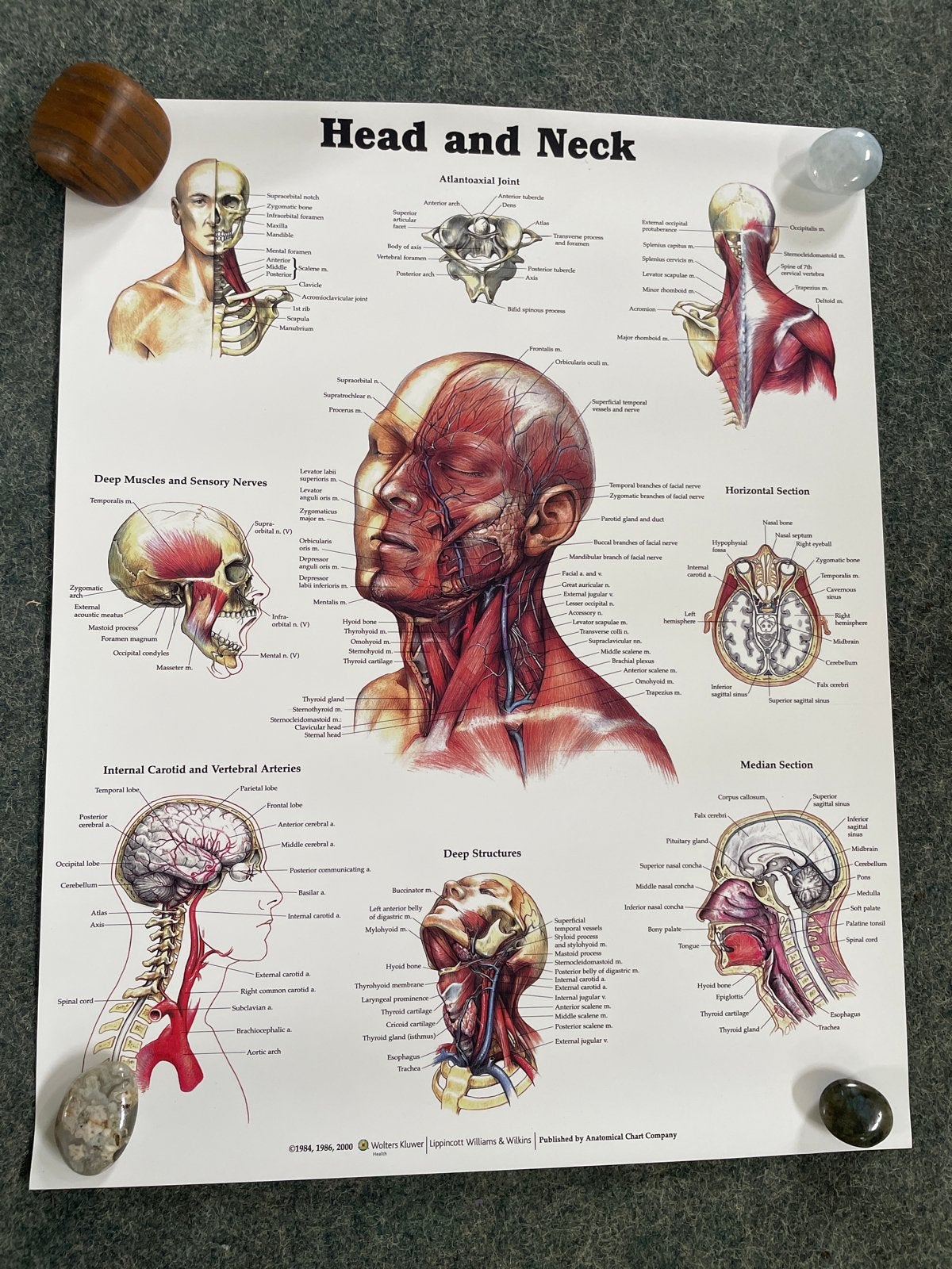 Anatomie Poster Hoofd en Nek - Medische Illustratie, Ophalen, Zo goed als nieuw, Natuurwetenschap