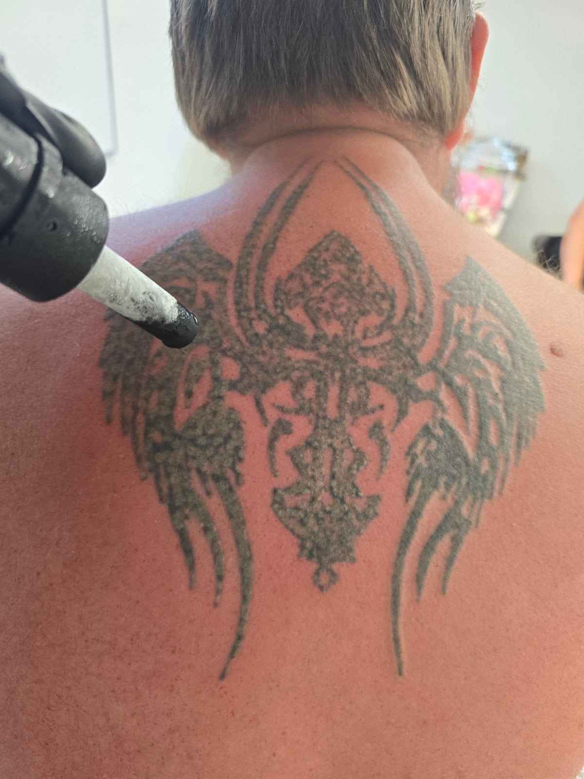 Tattoo Removal/tattoo vervagen €37,50, Ophalen, Nieuw
