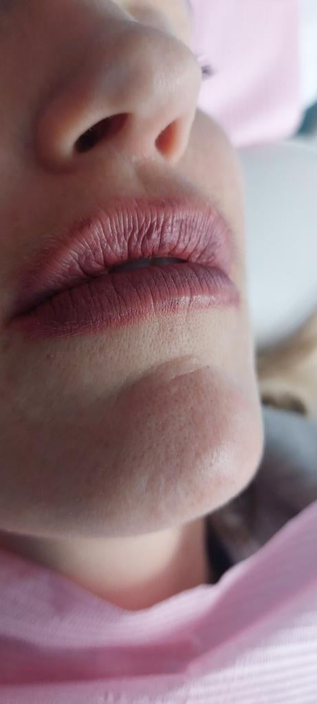 BB LIPS, Ophalen of Verzenden, Nieuw, Lipbalsem