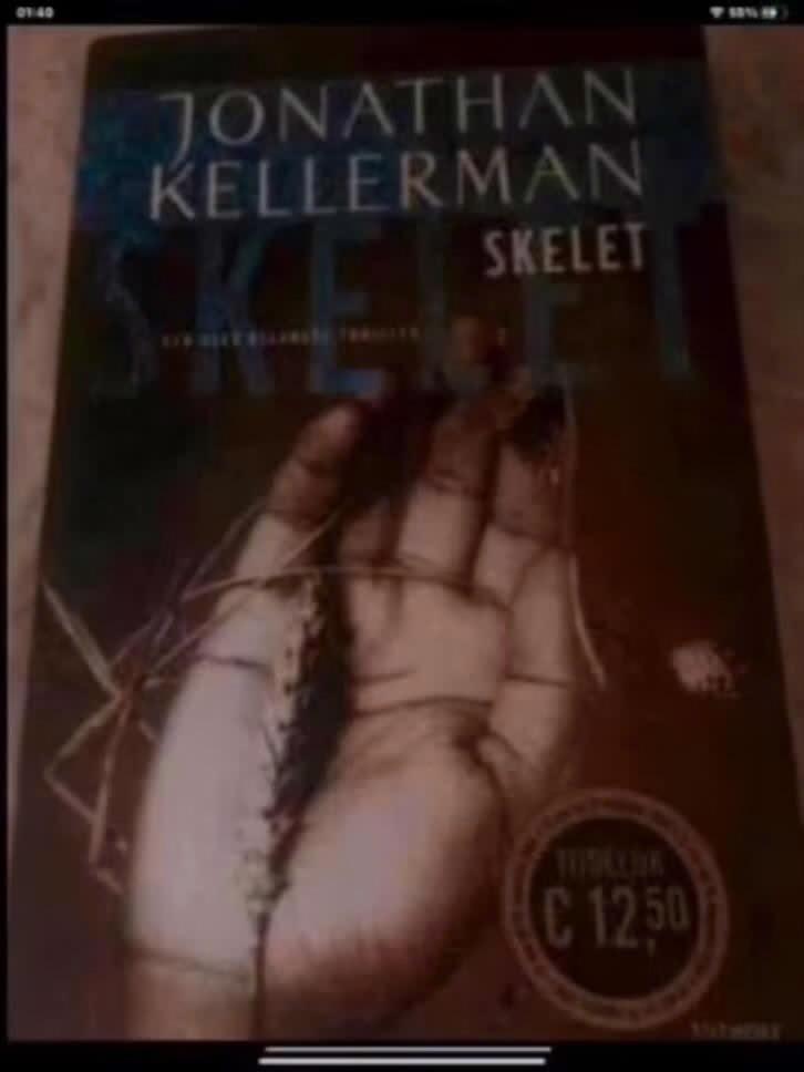 Skelet, Verzenden