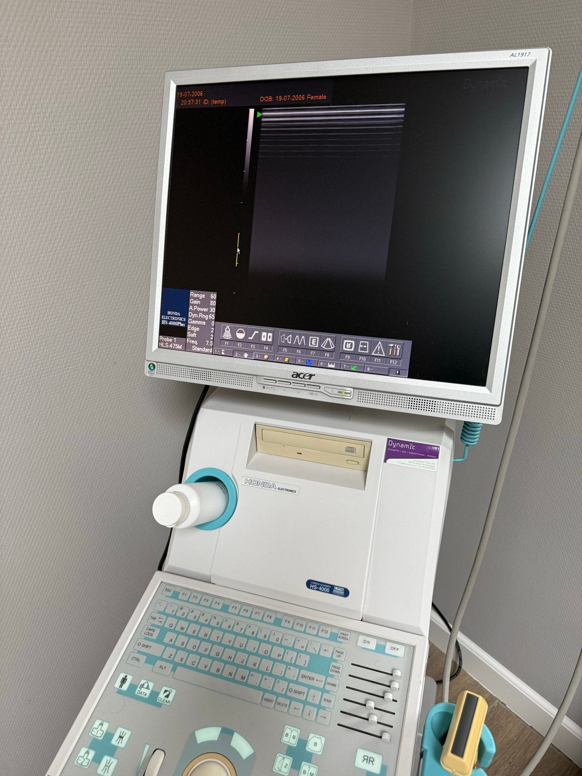 Honda HS-4000Plus Echografie Systeem met Acer Monitor, Ophalen