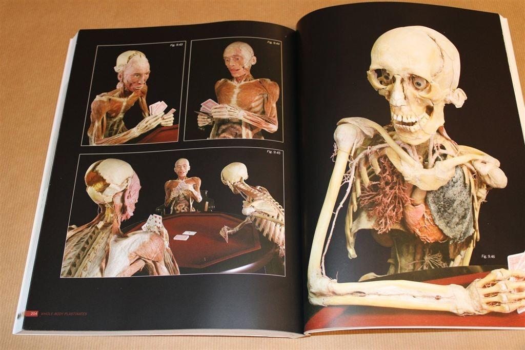 Body Worlds — De Wereld van het Menselijk Lichaam, Boeken, Ophalen of Verzenden, Zo goed als nieuw, Natuurwetenschap