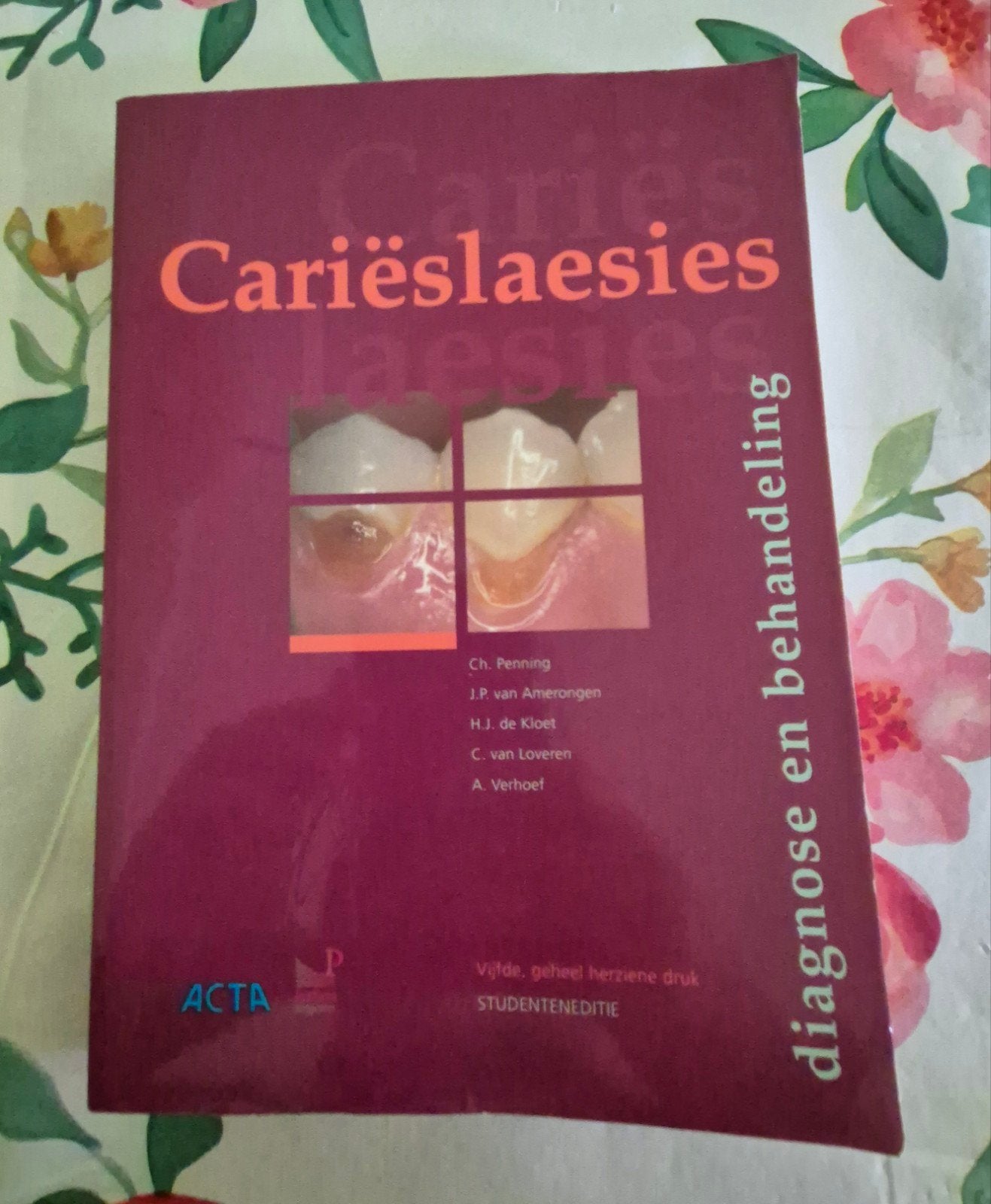Cariëslaesies: diagnose en behandeling - Tandheelkunde, Boeken, Ophalen of Verzenden, Beta, Zo goed als nieuw, HBO