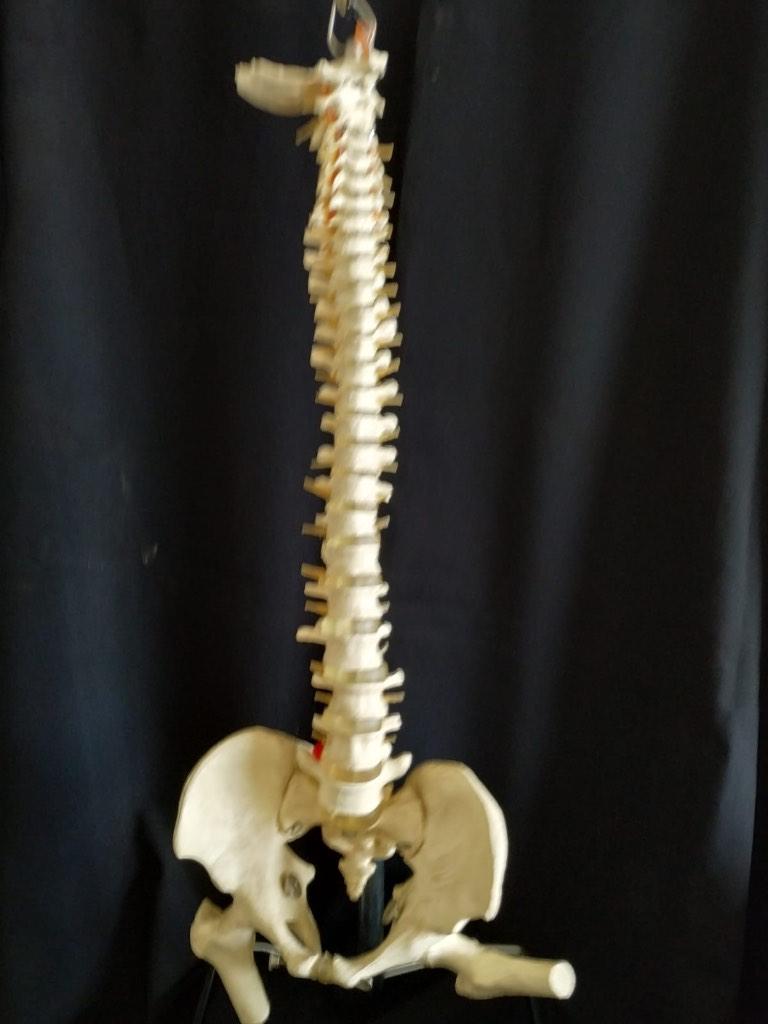 Medische skelet, Ophalen, Zo goed als nieuw, Overige typen