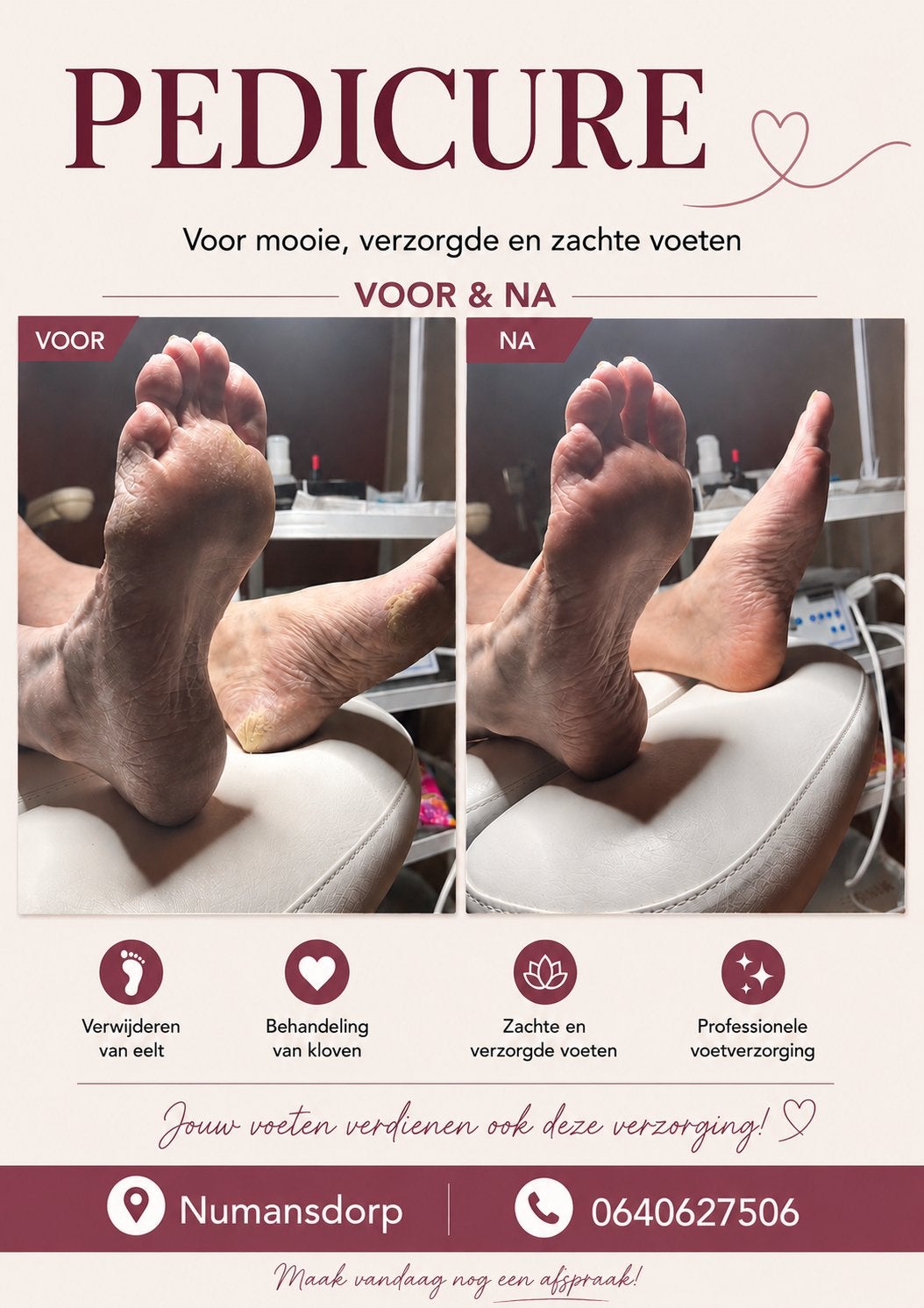 Aangeboden pedicure behandeling, Diensten en Vakmensen, Schoonheidsspecialisten | Pedicure