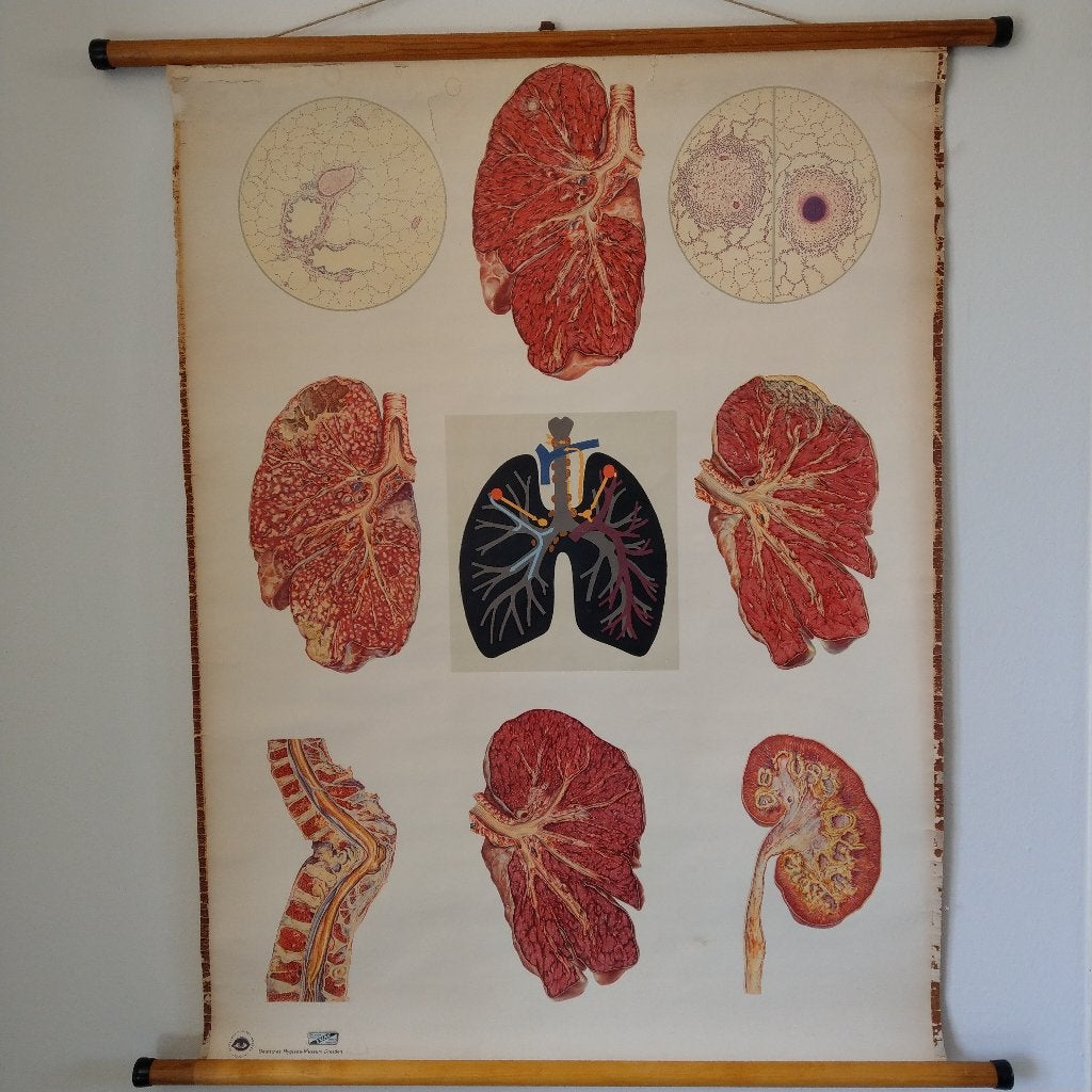 Medische schoolplaat Longen, Ophalen of Verzenden, Natuur en Biologie
