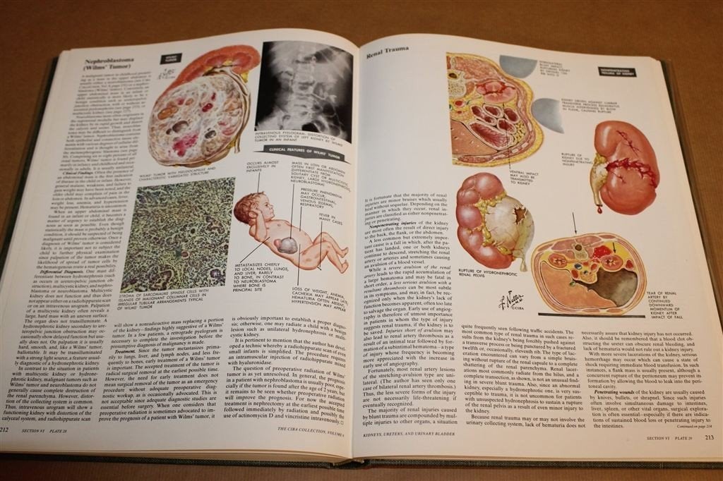 Kidneys, Ureters and Urinary Bladder — Netter, Ciba Deel 6, Boeken, Ophalen of Verzenden, Gelezen, Natuurwetenschap