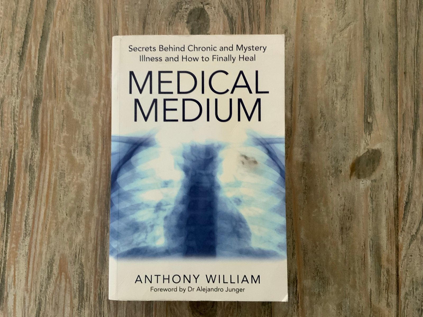 Medical Medium Engelse editie, Ophalen of Verzenden, Gelezen, Gezondheid en Conditie