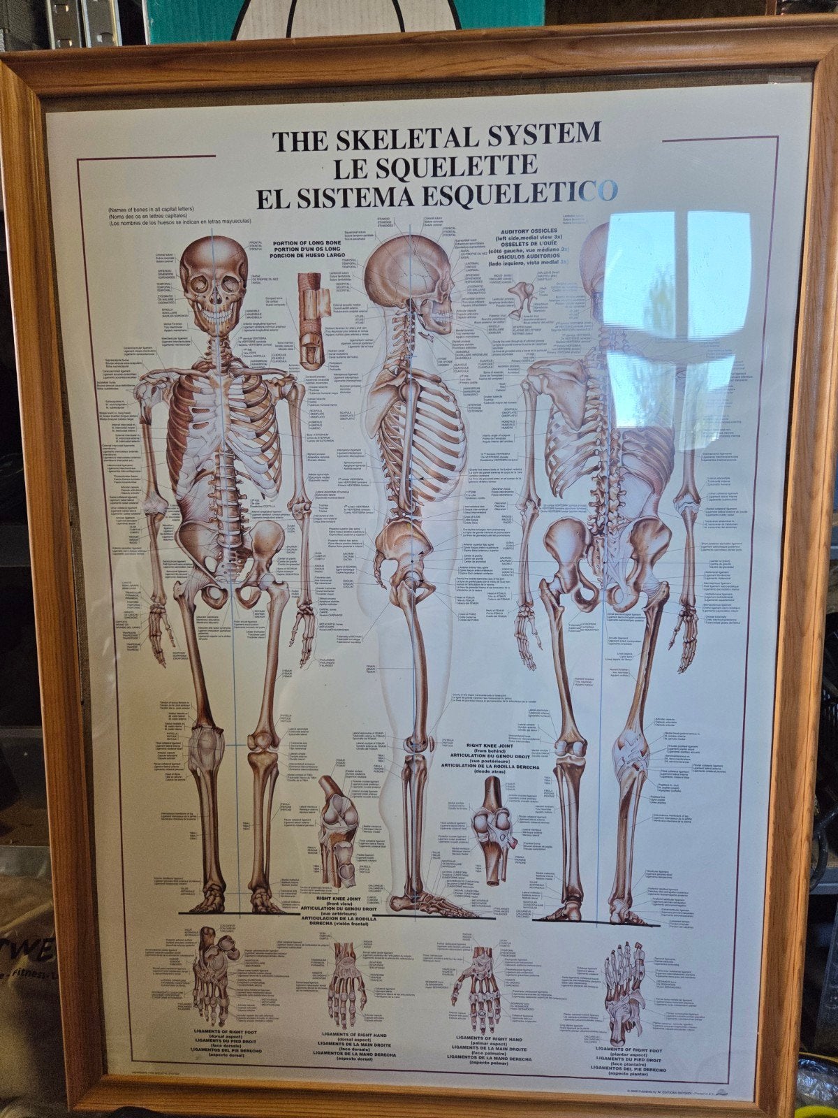 Anatomie poster, Ophalen