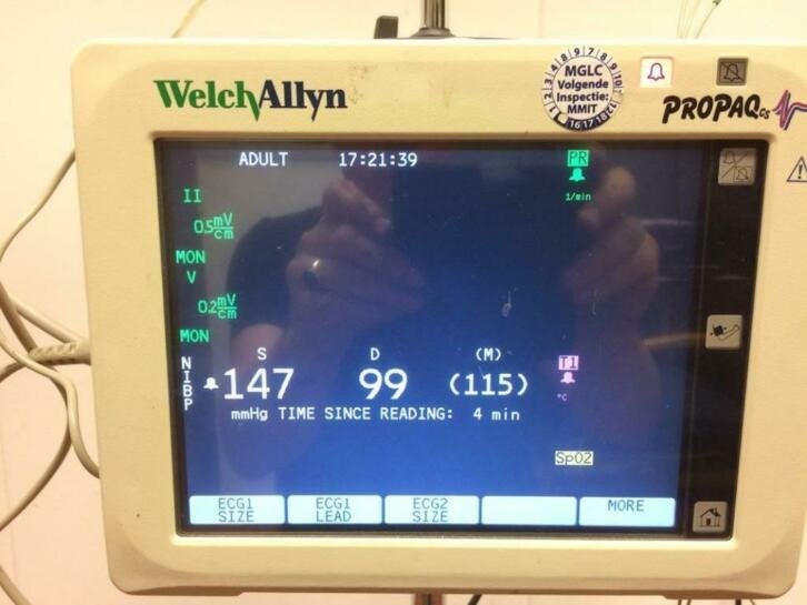 Welch Allyn Pro Paq medium care monitorset, Niet ingevuld, Gebruikt, Niet ingevuld, Ophalen of Verzenden