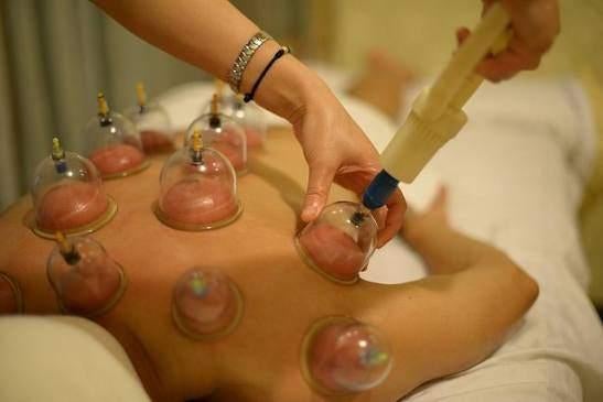 Hijama Cupping + massage for dames, Ophalen of Verzenden