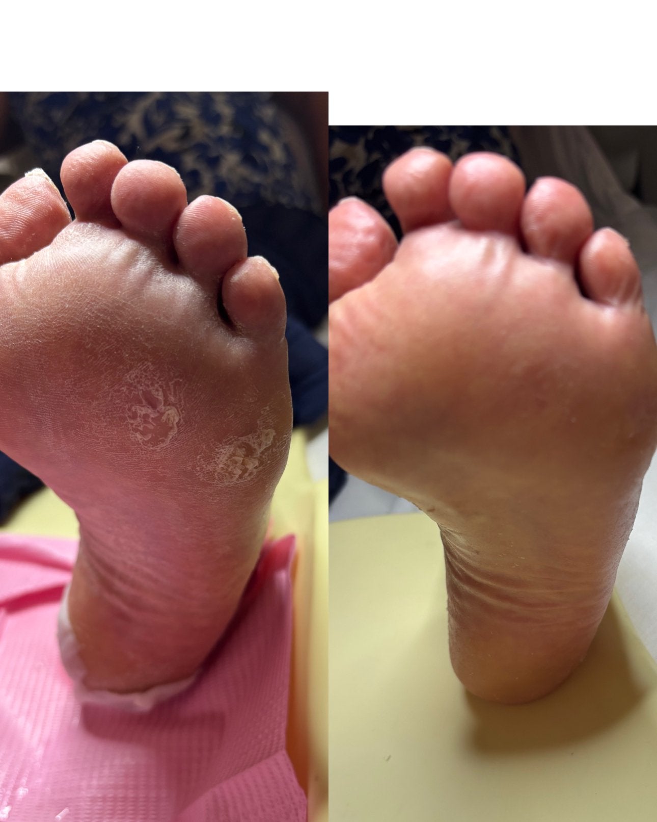 Pedicure aanbod, Diensten en Vakmensen, Schoonheidsspecialisten | Pedicure, Voetverzorging