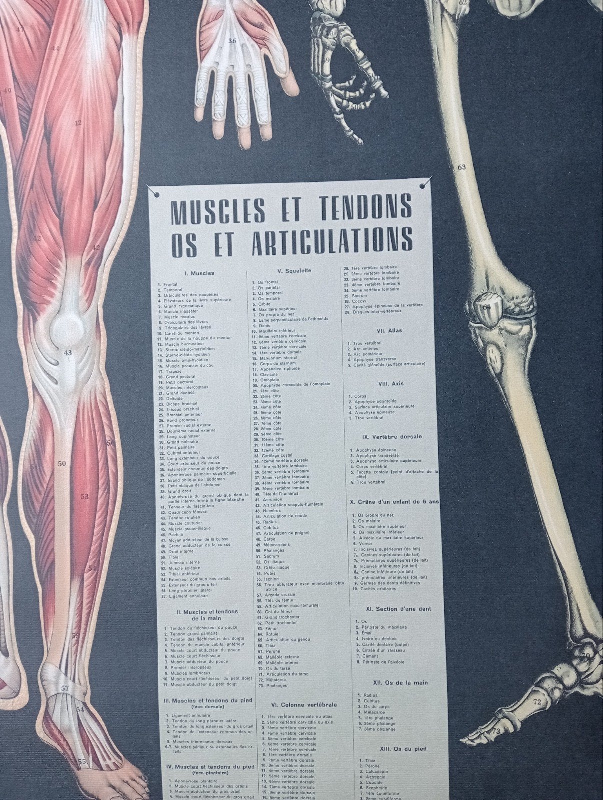 L'Anatomie Frankrijk medische anatomische poster, Ophalen of Verzenden, Gebruikt, A1 t/m A3, Film en Tv
