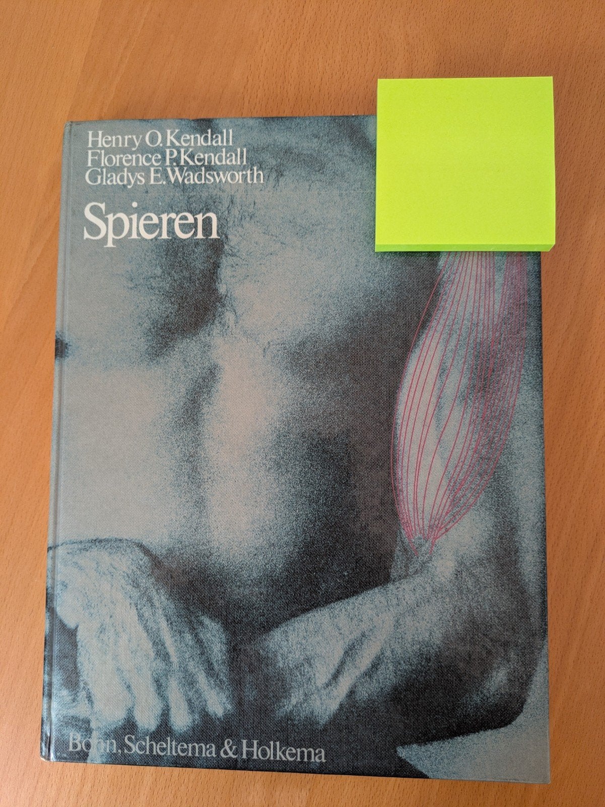 Spieren: Tests en functies - Kendall (1982) - Nieuwstaat, Boeken, Studieboeken en Cursussen, Henry O. Kendall, Florence P. Kendall, Gladys E. Wadsworth