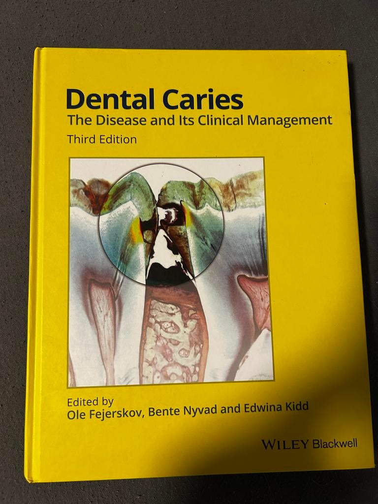Dental Caries: The Disease and Its Clinical Management, Boeken, Ophalen of Verzenden, Zo goed als nieuw
