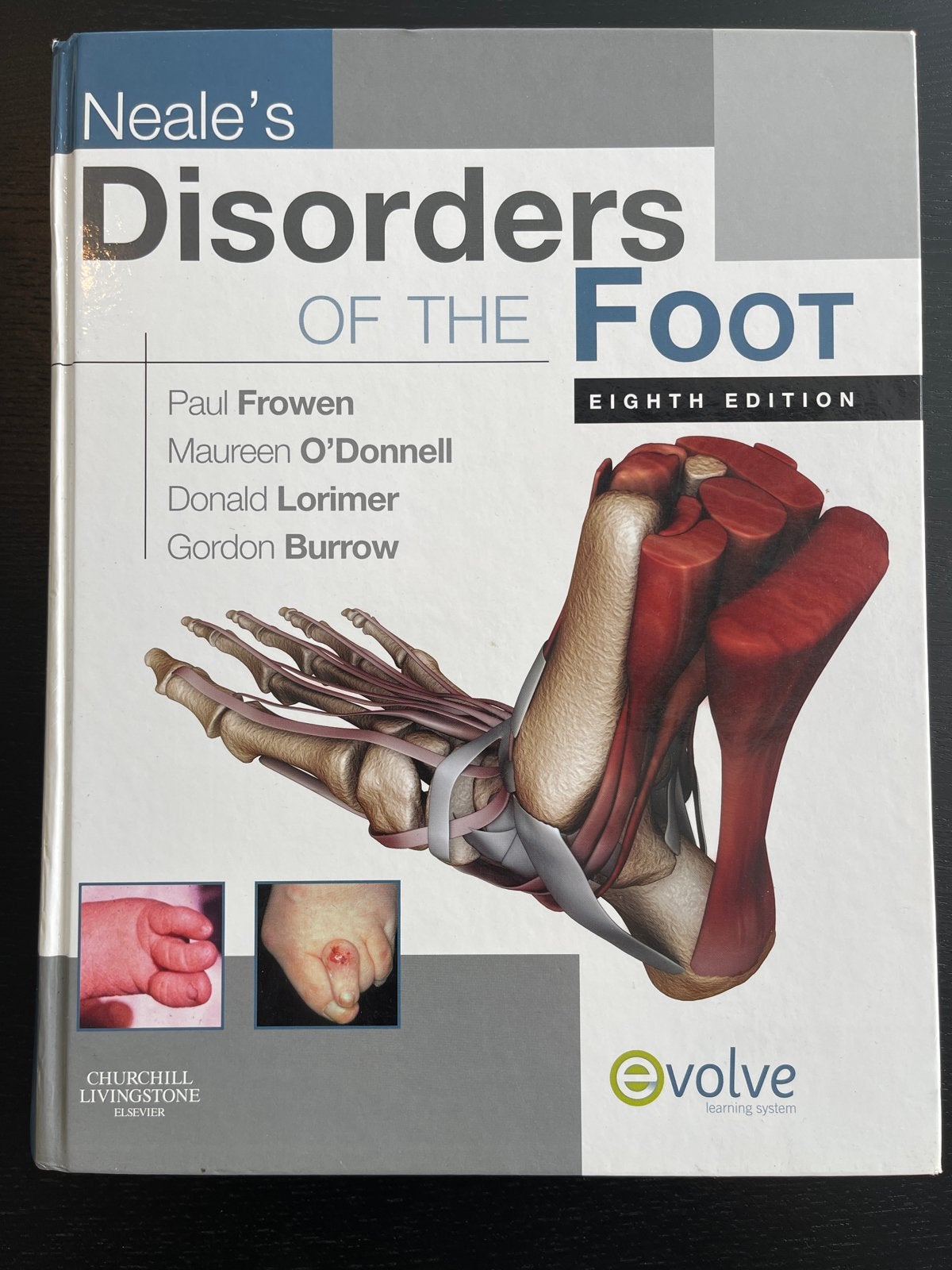 Neale's Disorders of the Foot - Achtste Editie, Ophalen of Verzenden, Beta, Zo goed als nieuw, HBO