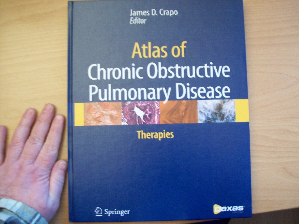 Crapo: Atlas of Chronic Obstructive Pulmonary Disease (COPD), James D. Crapo, Niet van toepassing, Nieuw, Ophalen of Verzenden